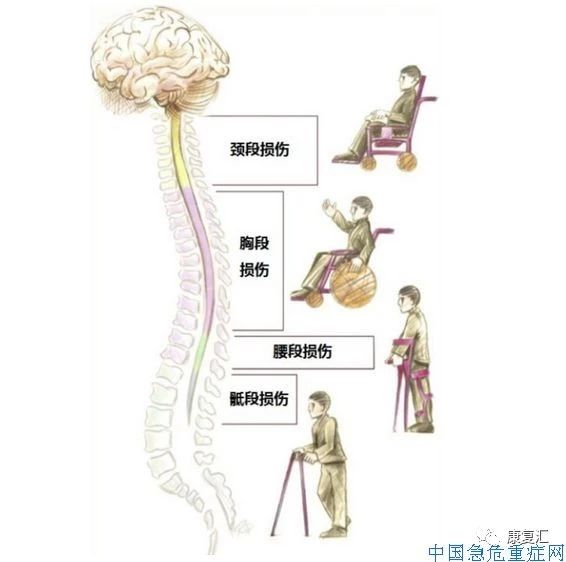 全球脊髓損傷研究最新進(jìn)展，探索自然美景的治愈之旅